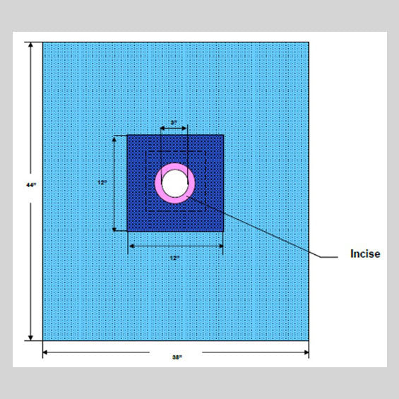 Brachial Drape with 3" Circular Fenestration and Incise