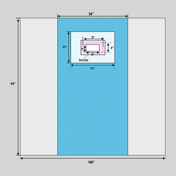 Fistula Drape