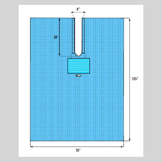 EENT Split Drape without Split Reinforcement